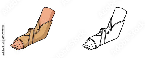 Medical arm splint illustration in color and linear outline style with beige support brace on a human hand representing orthopedic fracture treatment equipment on white background