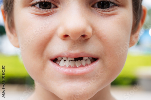 Wallpaper Mural Cute child smiling with missing baby tooth outdoors Torontodigital.ca
