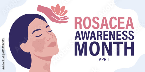 Understanding Rosacea Awareness Month in April