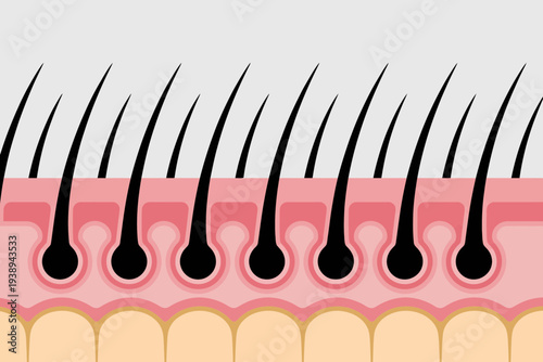 Cross-section of human skin showing hair follicles and hair shafts