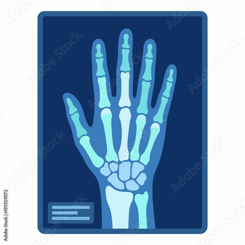 An informative digital X-ray showcasing the bones of a human hand, exemplifying the wonders of modern medicine and technology in the field of healthcare and anatomy.