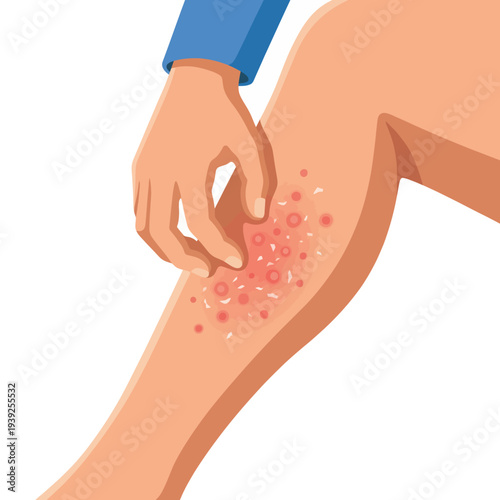 This detailed illustration shows a person scratching their leg, focusing on skin irritation, providing a realistic view of discomfort while emphasizing human emotions and sensations.