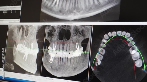 CT dental clinic analysis of patients jaw. X-Ray image on computer display. CT and MRI scanning. healthcare, Dental MRI software screen. Monitoring dental health using skull scan. 4 k video