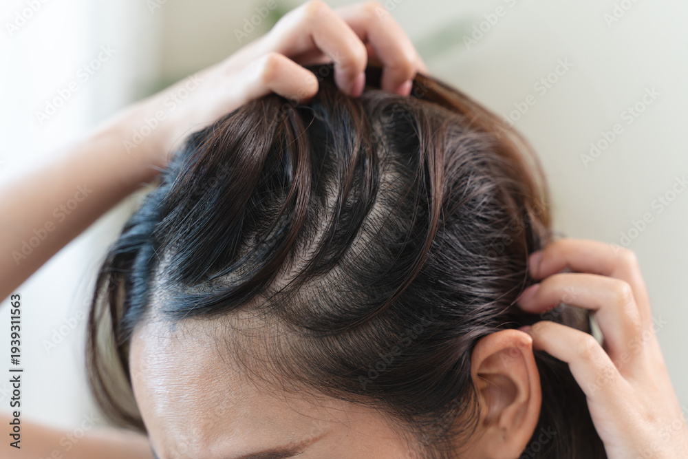 Fototapeta premium Young woman scratching her head feeling itch from dermatology problem