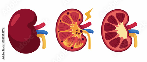 This image presents a vibrant, stylized depiction of kidney anatomy, showcasing essential structures like blood vessels and ureters in a visually engaging manner.