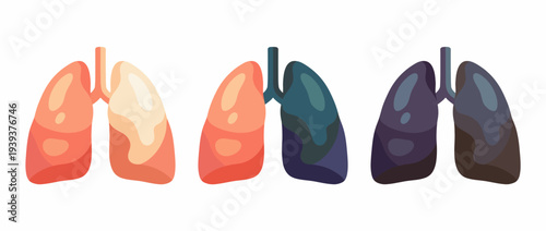 This artistic depiction of lungs in various shades symbolizes health and wellness, encouraging awareness about respiratory health and the importance of clean air for life.