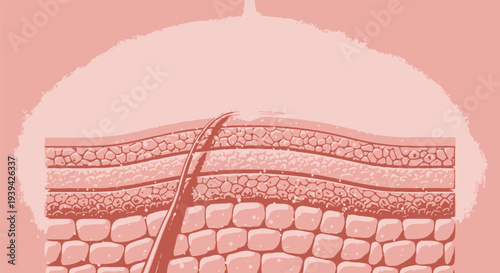 Detailed cross-section illustration of human skin layers and hair follicle.