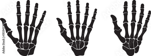Skeleton Hand Vector Pack: Bone X‑Ray Silhouettes .