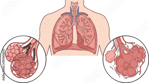 Illustration of human lungs with close-ups of alveoli and bronchioles, depicting respiratory system anatomy