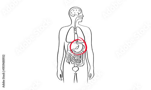 Gastroesophageal reflux pain