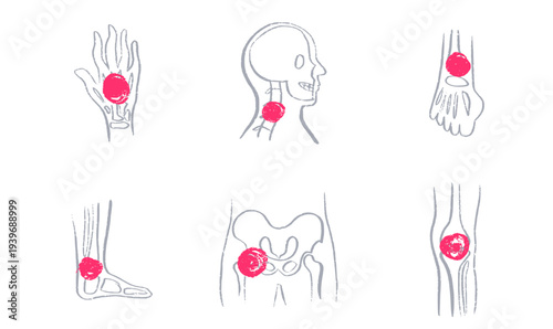 Arthritis Sketch Poster
