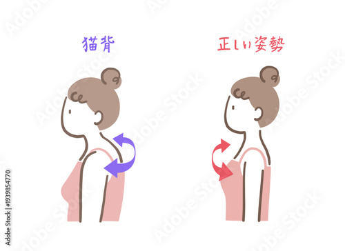 まっすぐした姿勢と猫背の女性のイラストセット