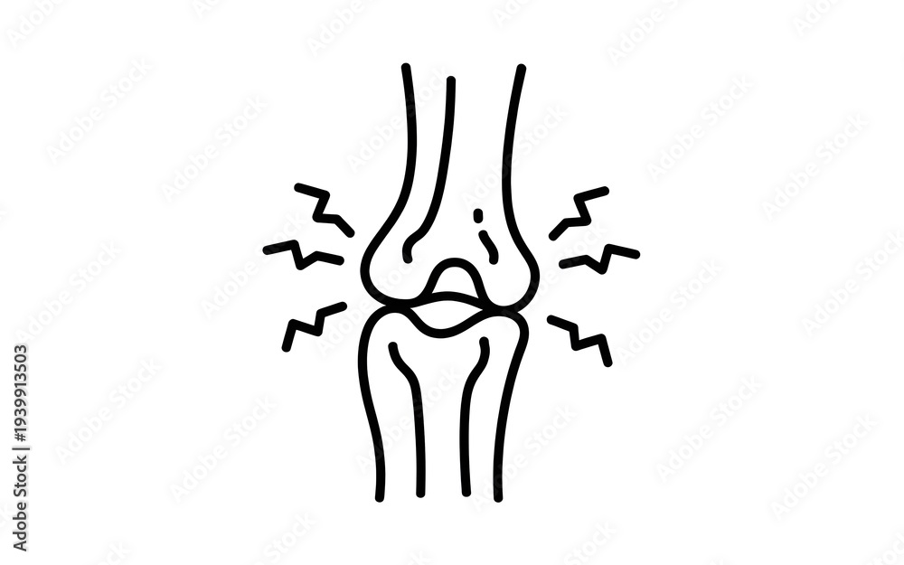 Obraz premium Painful knee joint with inflammation and discomfort