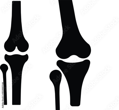 Human Knee Joint Anatomy Skeletal Icons Set