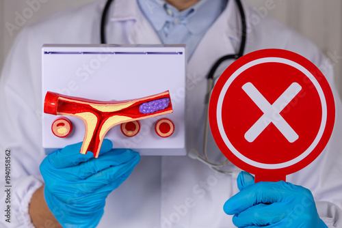 Fotografía Gros plan sur un médecin en train de montrer dans une main un panneau croix rouge, et de l'autre main, un modèle 3D d'une artère bouchée avec de la graisse