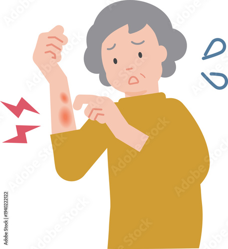 乾燥による肌荒れとかゆみに悩む高齢女性