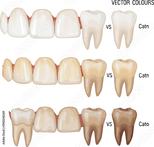 Create a realistic Close-up image comparing different tooth colors vector art with white background..
