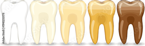 Isolated a realistic Close-up image comparing different tooth colors vector art with white background.