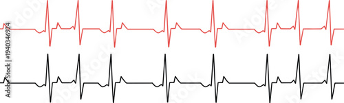 Electrocardiogram heartbeat waveform pattern in red and black showing cardiac rhythm monitoring and medical pulse signals isolated on light background healthcare design