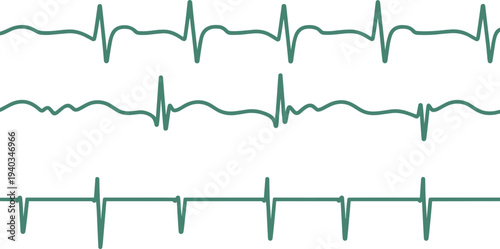 Green electrocardiogram heartbeat waveform collection showing cardiac rhythm patterns and medical pulse monitoring signals isolated on light background for healthcare design