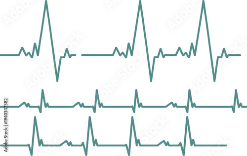 Green electrocardiogram heartbeat waveform set showing different cardiac rhythm patterns and medical pulse monitoring signals isolated on light background healthcare design
