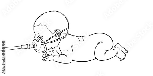 Premature Baby with Respiratory Support Silhouette