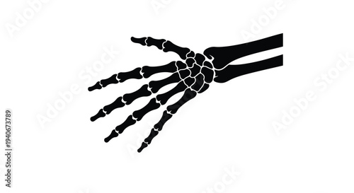Anatomical illustration of a human hand showing skeletal structure