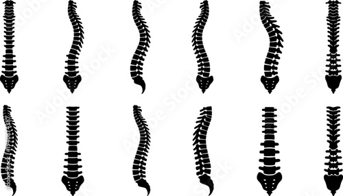 Black Spine Illustrations Medical Anatomy Diagrams Set
