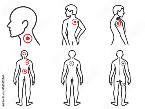 Human body with highlighted pain points and muscle areas