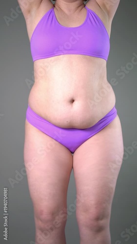 Overweight woman showing fat before liposuction or tummy tuck, featuring shaking and jiggling flabby, saggy excess weight on her belly, lymph drainage massage
