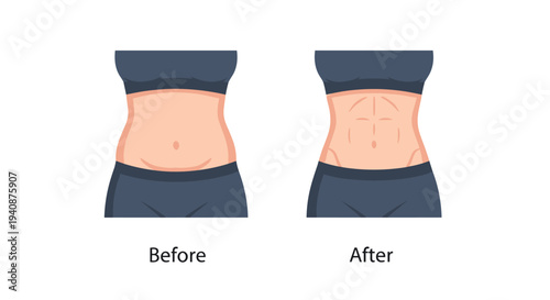 Two female torsos with 'Before' and 'After' labels demonstrate a weight loss journey from a rounded to a muscular abdomen.
