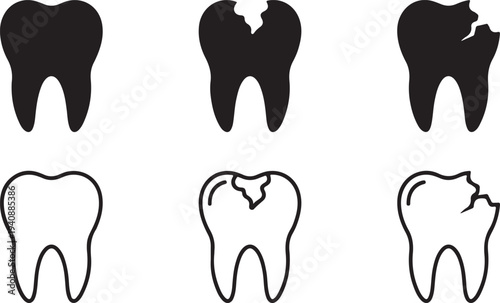 Molars Illustration Set: Healthy, Decayed, and Chipped Teeth in Black and Outline, Flat Design