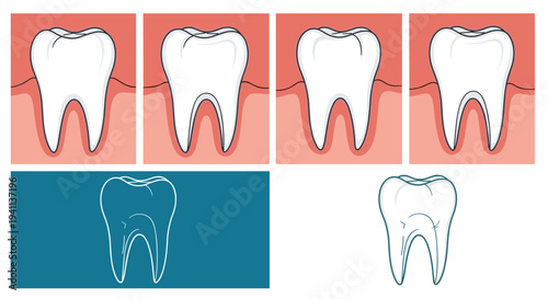 Detailed medical illustration showing the structure of human teeth and healthy gums in both color and line art styles.