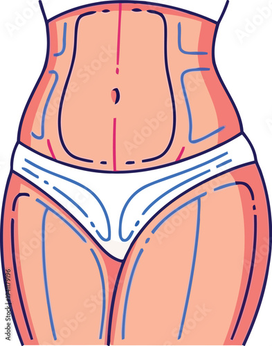 Plastic surgery body mapping on female silhouette vector design