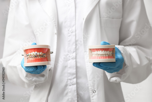 Dentist holding jaw models,...