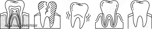 Set of five dental icons illustrating tooth structure, cracked tooth, toothache sensitivity, healthy gums, and a standard tooth symbol for professional oral healthcare design. (25 words)