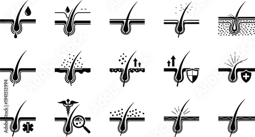 Hair follicle and scalp condition icons set showing oil dandruff growth protection treatment dermatology medical vector illustration collection
