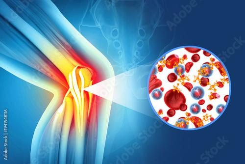 Platelet-Rich Plasma (PRP) therapy. Knee joint. 3d illustration