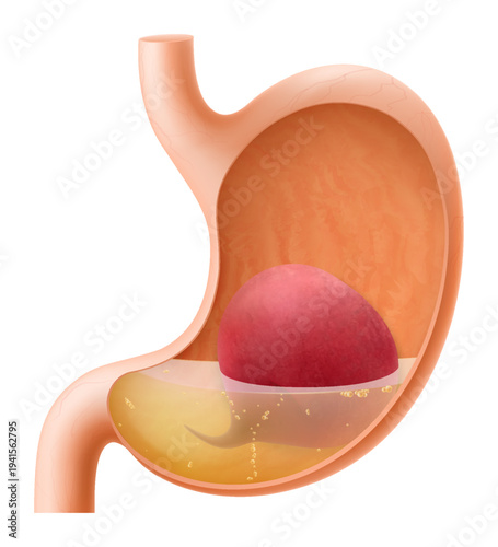 Human Stomach with beetroot. The stomach digests beets. A stomach filled with healthy and wholesome food. Proper nutrition. Realistic 3d Vector illustration. Food digestion process illustration