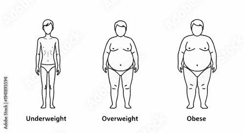 Human Body Types Underweight Overweight Obese.