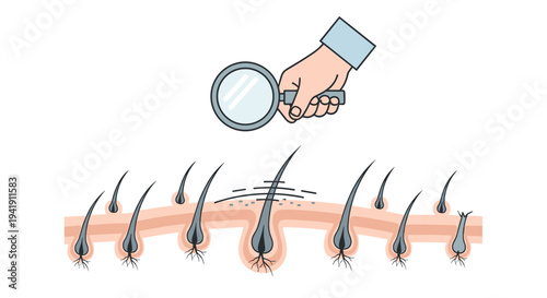 A cartoon hand holds a magnifying glass over a cross-section of skin, revealing hair follicles with roots and visible dandruff flakes.