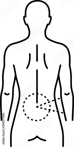 Medical illustration depicting human back with a marked lower back pain area representing discomfort or injury