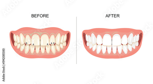 A Before and After dental comparison displays a human mouth with yellowed, cavity-ridden teeth on the left, contrasted with perfectly white, healthy teeth on the right.