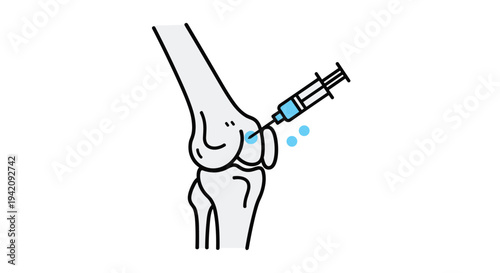 A simplified outline illustration of a human knee joint receives an injection from a syringe, with blue liquid droplets visible.