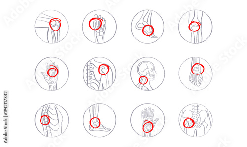 Arthritis Sketch Poster