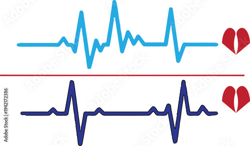 Ecg heartbeat monitor and electrocardiogram rhythm comparison