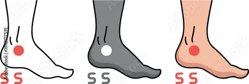 Minimalist foot arch types diagram showing flat foot, normal arch and high arch medical podiatry vector illustration