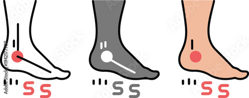 Minimalist foot arch types diagram showing flat foot, normal arch and high arch medical podiatry vector illustration