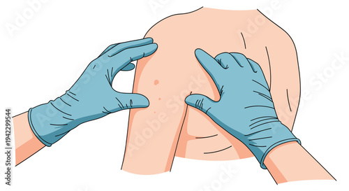 A pair of gloved hands gently examines a patient's bare upper arm and shoulder, revealing small moles on the skin.