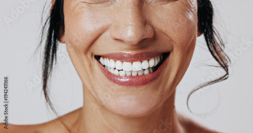 Dental, smile or woman in studio with mouth, closeup or tooth wellness in orthodontics. Happiness, veneers and person on white background with hygiene, teeth whitening and dentistry in oral health.